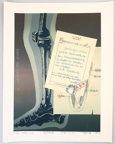 Cheng Guangyong born 1973 - The Images of X-Ray - No. 3 - artelino Art Auctions. Cheng Guangyong born 1973 - The Images of X-Ray - No. 3
